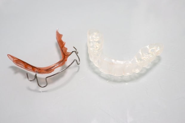 後戻りを防ぐカギは「保定期間」 リテーナーの種類と正しい使い方