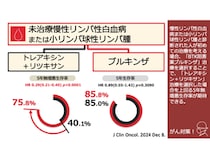 「慢性リンパ性白血病」の生存率が延びる治療法とは? 5年間追跡の結果で明らかに