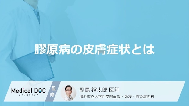 「膠原病」を発症すると「皮膚」にどんな症状が現れるかご存知ですか？【医師監修】