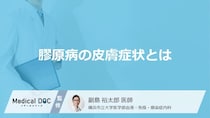 「膠原病」を発症すると「皮膚」にどんな症状が現れるかご存知ですか？【医師監修】