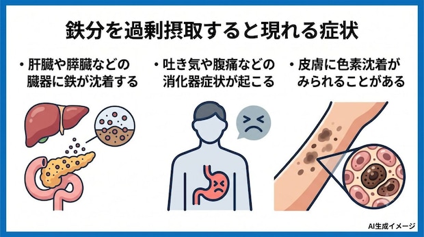 鉄分を過剰摂取すると現れる症状
