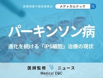 「パーキンソン病」治療に新たな一手! “日本発”iPS細胞、アメリカで患者移植に初成功