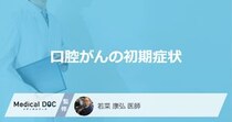 「口腔がんの初期症状」はご存知ですか？医師が監修！