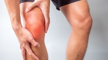 我慢できる膝の痛みが悪化を招くことをご存じですか？ スポーツ継続の目安を医師が解説