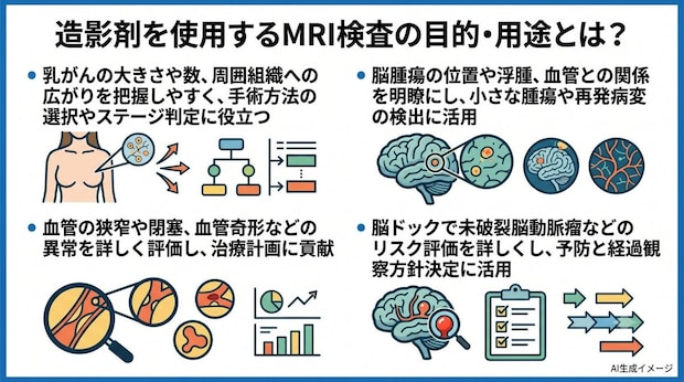 造影剤を使用するMRI検査の目的･用途とは？