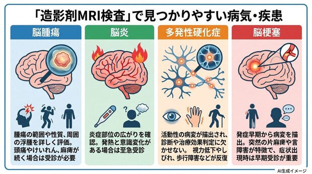 「造影剤MRI検査」で見つかりやすい病気・疾患
