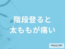 「階段を登ると太ももが痛い」原因はご存知ですか？医師が監修！