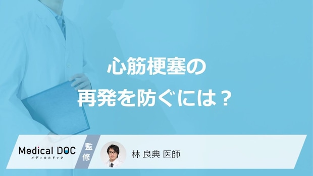 何が「心筋梗塞」の再発リスクを高くするかご存じですか？3つの予防法を医師が解説！