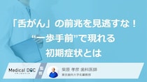 「舌がん」の前兆を見逃すな！“一歩手前”で現れる初期症状とは