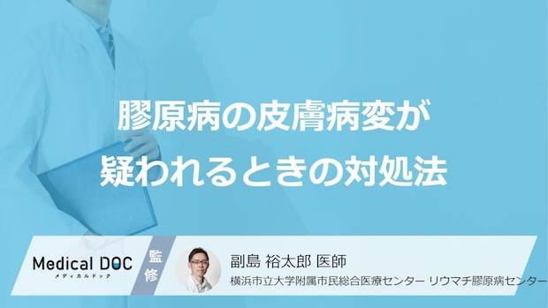 受診の目安となる「膠原病の皮膚症状」はご存知ですか?【医師監修】
