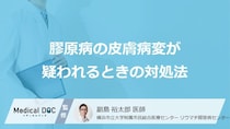 受診の目安となる「膠原病の皮膚症状」はご存知ですか？【医師監修】