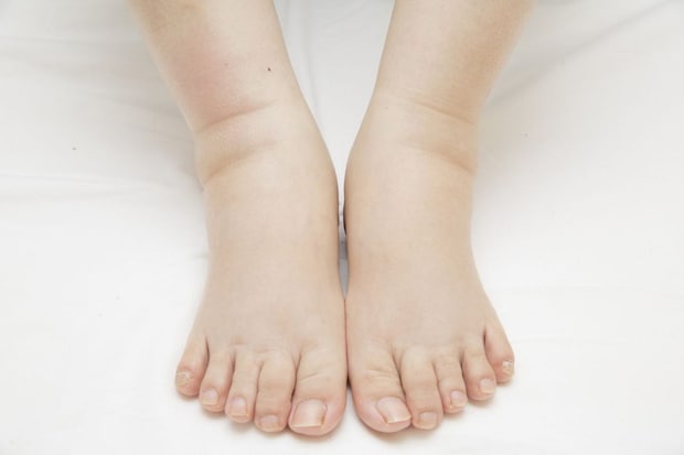 むくみからはじまった異変――。病気発覚と治療への第一歩