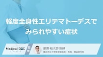 軽度の「全身性エリテマトーデス」ではどんな症状が現れる？気付きやすいサインを解説！