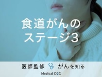 「食道がんステージ3」の症状・治療法はご存知ですか？医師が監修！