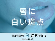 「唇に白い斑点」ができる原因はご存知ですか？医師が徹底解説！