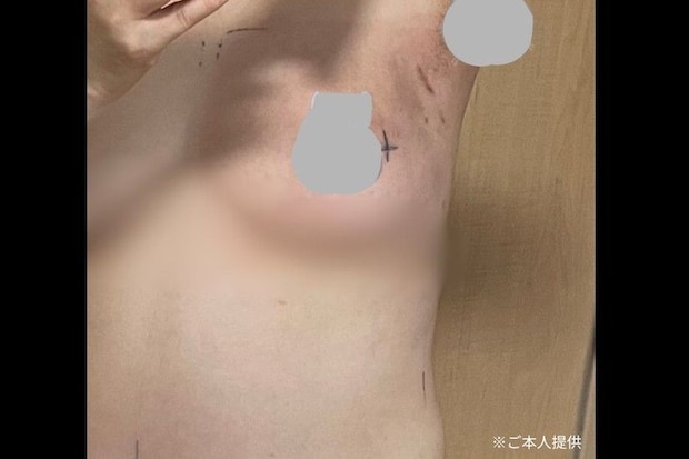 「わたしはがん患者なんだ」