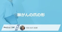「爪の形」がどのように変化したら「肺がん」を疑った方がいい？3つの特徴を医師が解説！