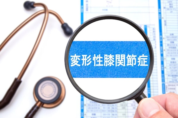 変形性膝関節症の早期発見！ どんな初期症状があるの？
