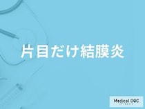 「片目だけ結膜炎」になる原因はご存知ですか？日常生活での注意点も解説！【医師監修】