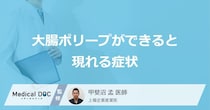 「大腸ポリープができると現れる主な2つの症状」はご存知ですか？【医師解説】