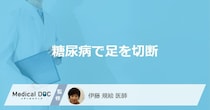 「糖尿病で足を切断」する判断基準とは？糖尿病で足を切断する理由も解説！
