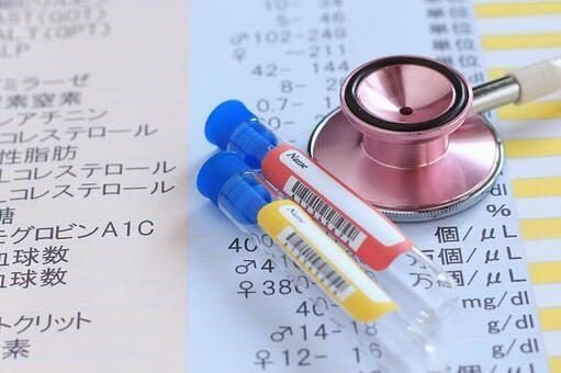 アジソン病の診断に用いる検査