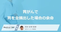 「胃がんで胃を全摘出した場合の余命」はどれくらいかご存知ですか？医師が解説！