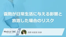 『バルトリン腺嚢胞』で女性が注意すべき“3つの初期症状”と放置リスクとは【医師監修】