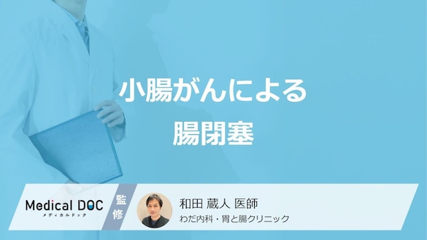 「小腸がん」が進行するとなぜ”腸閉塞”を起こすのかご存じですか?医師が解説!