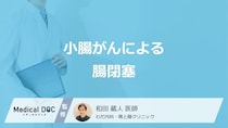 「小腸がん」が進行するとなぜ”腸閉塞”を起こすのかご存じですか？医師が解説！