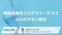 軽度の「全身性エリテマトーデス」ではどんな症状が現れる？気付きやすいサインを解説！