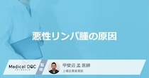 「悪性リンパ腫の主な2つの原因」はご存知ですか？症状についても医師が徹底解説！