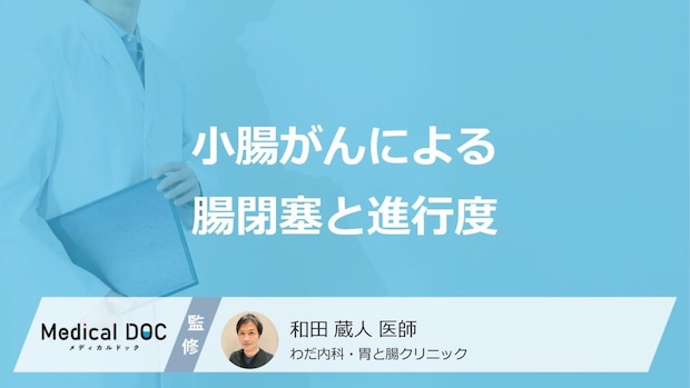 「小腸がん」で”腸閉塞”になったときの進行度はどのくらい？治療法も医師が解説！