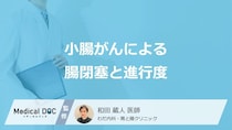 「小腸がん」で”腸閉塞”になったときの進行度はどのくらい？治療法も医師が解説！