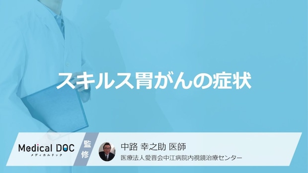 「スキルス胃がん」の”初期症状”はご存じですか？通常の胃がんとの違いも医師が解説！
