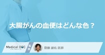 「大腸がんの血便」はどんな色かご存知ですか？医師が徹底解説！
