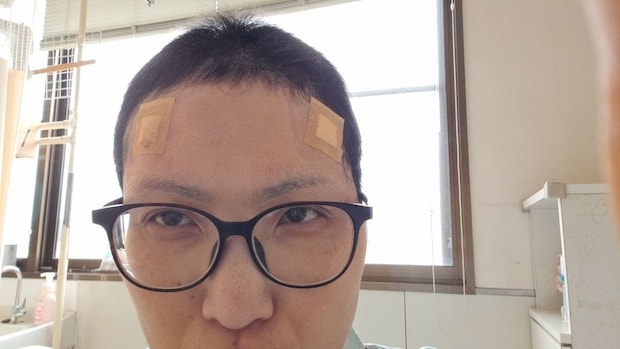 副作用との闘い、そして「生きることを絶対に諦めてはいけない」