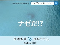 なぜニキビは同じ場所に何度もできるのかご存じですか？ 理由を医師が解説