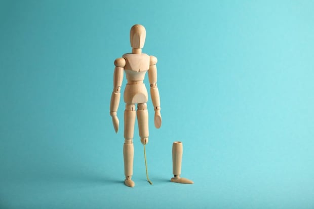 糖尿病で足の切断にいたるまでの経過と切断後の生活