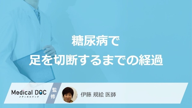 「糖尿病で足を切断」するまでの症状の進み方はご存知ですか？【医師監修】