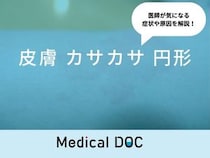 「皮膚に円形のカサカサ」ができる原因はご存知ですか？医師が徹底解説！