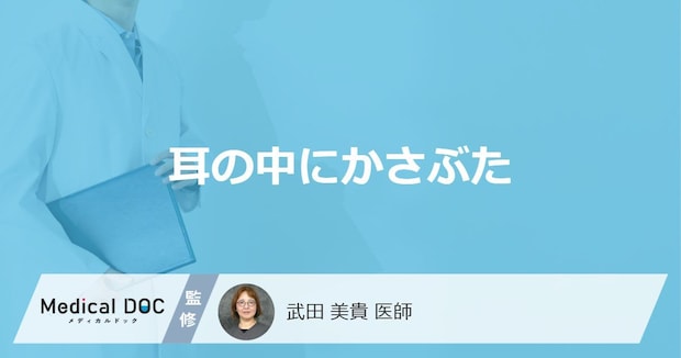 「耳の中にかさぶた」ができる原因はご存知ですか?血が出る・汁が出る原因も解説!