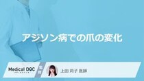 「アジソン病」を発症すると「爪」にどんな症状が現れるかご存知ですか？【医師監修】