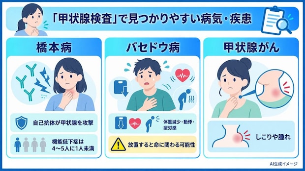 「甲状腺検査」で見つかりやすい病気・疾患