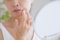 「シミ取りレーザー」の効果を医師が解説 効率的にシミを消す方法･失敗しないポイントは？