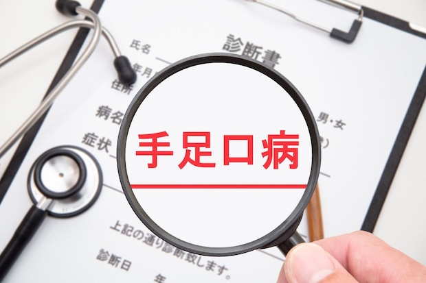 まず知りたい！ 手足口病ってどんな病気？