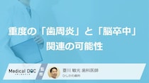 【愛知学院大が5年追跡】重度の「歯周炎」と「脳卒中」に関連の可能性 予防のポイントを歯科医が解説