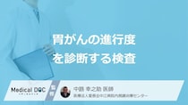 「胃がん」をCT検査する際に”造影剤”は必要かご存じですか？検査法を医師が解説！