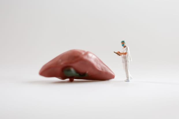 肝臓の数値が悪いときに疑われる病名は？