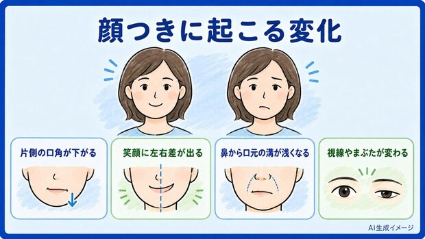 脳梗塞を発症すると顔つきはどのような変化が起こる?